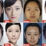 About Face: China’s Plastic Surgery Market Grows Six Times Faster Than Global Average